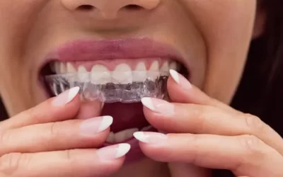 Invisalign Scottsdale: Clear Aligner Therapy for Discreet Orthodontic Correction